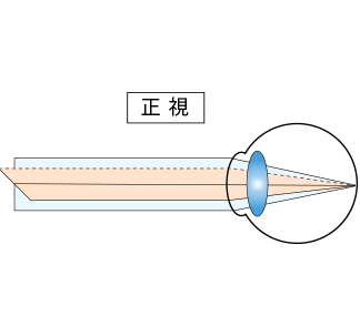 正視