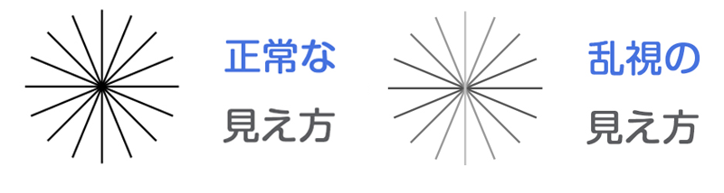 乱視矯正白内障手術 手術 えのき眼科 埼玉県狭山市の眼科